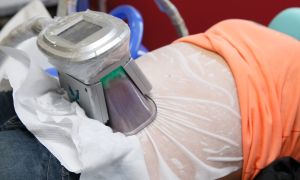 Prática Criolipólise Seminários Clínicos Enfermagem Estética