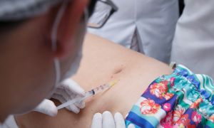 Intradermoterapia: técnica feita com enzima está entre os melhores tratamentos estéticos
