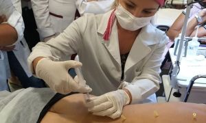 Enfermeiro pode trabalhar com ozonioterapia na estética