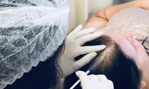 Conheça as 5 enzimas queridinhas da mesoterapia