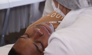 Paciente Modelo - Enfermagem Estética