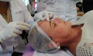 intradermoterapia enfermagem estética