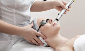 laserco2 procedimentos estéticos