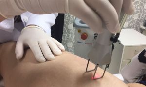 Entenda os procedimentos que a enfermeira esteta pode fazer