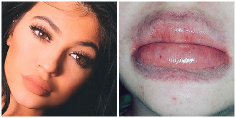 KylieJennerChallenge