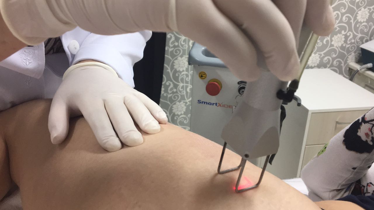 Entenda os procedimentos que a enfermeira esteta pode fazer