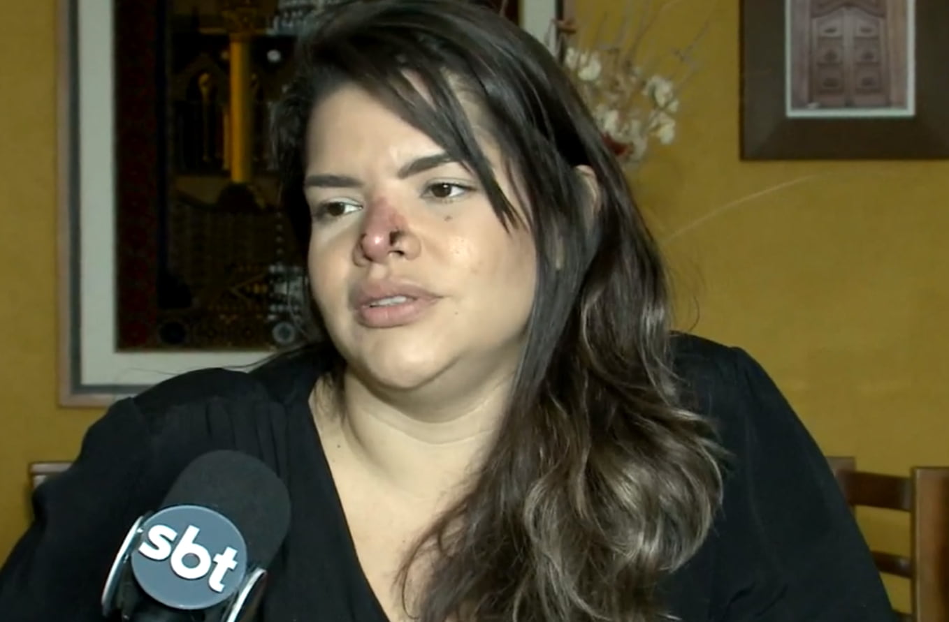 Priscila Aguiar - Rinomodelação