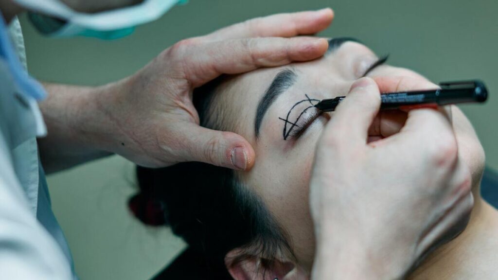 dermatologista - ácido hialurônico causou a oclusão de artéria da retina