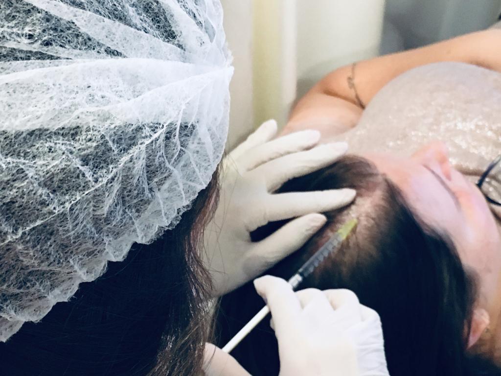 Conheça as 5 enzimas queridinhas da mesoterapia