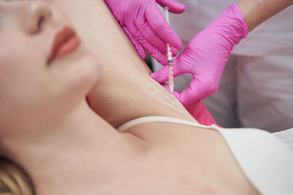 Hiperidrose axilar: como a toxina botulínica pode transformar a vida do paciente e do profissional